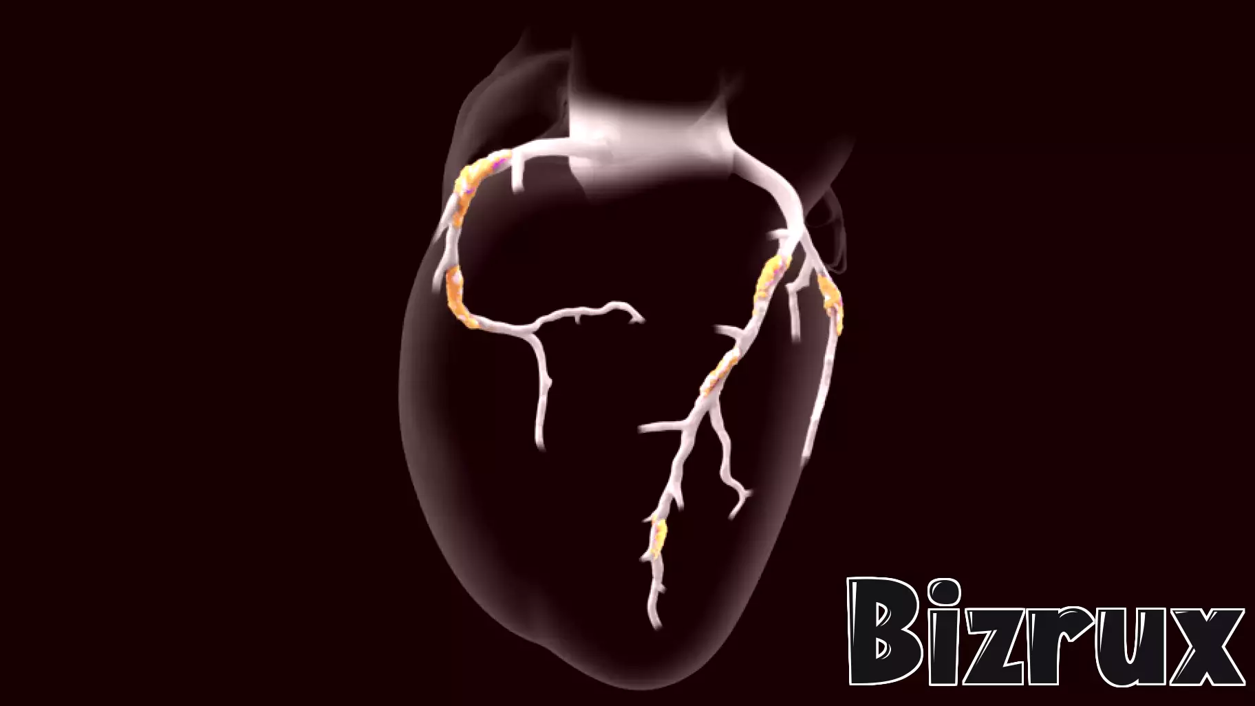 Heartflow launches new AI-powered staging tool for coronary plaque assessments