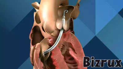 FDA warns that Johnson & Johnson heart pump sensors may malfunction—22 injuries reported