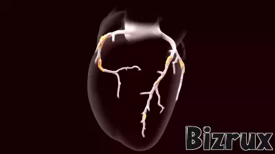 Heartflow launches new AI-powered staging tool for coronary plaque assessments